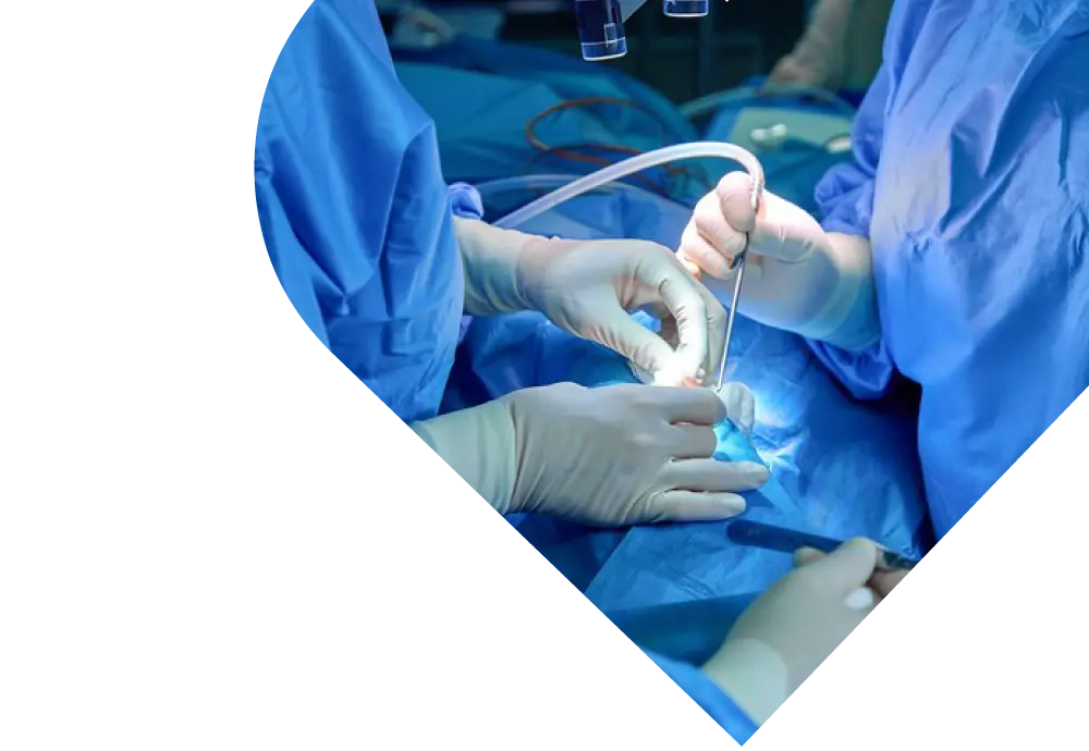 https://www.medicalwellness.me/wp-content/uploads/2023/10/surgery.webp